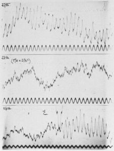 Human brain waves first recorded by Hans Berger